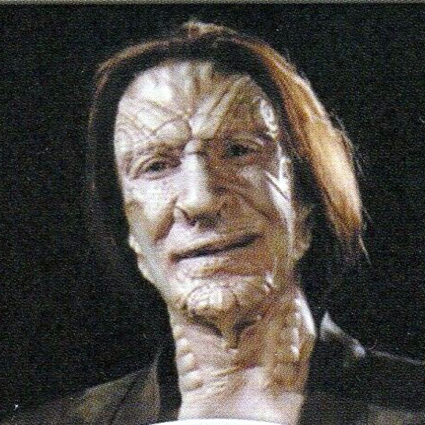 Robin Sachs Robin Sachs